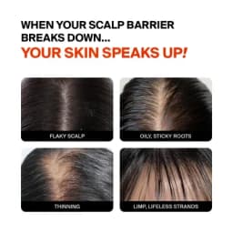 Purcell Pixcell Biom™ Tonic For Hair Density - 2